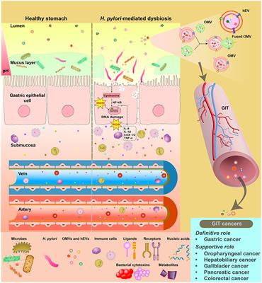 Helicobacter pylori infection and inflammatory events: the extracellular vesicle-connect in driving gastrointestinal tract cancers